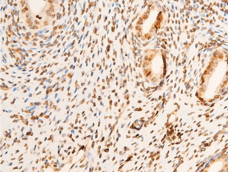 Polyclonal Rabbit anti-Human EIF2S1 Antibody (phospho-Ser51, IHC, IF, WB)