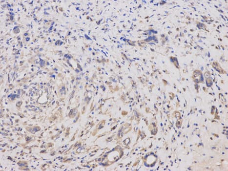 IHC-plus™ Polyclonal Rabbit anti-Human KLK1 / Kallikrein 1 Antibody (IHC, WB)