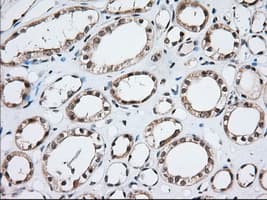 MOB1B / MOBKL1A Antibody (clone OTI3G9, Carrier-free)