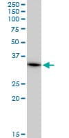 BM022 / MRPL1 Antibody (clone 2C4)