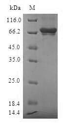 Human SULT2B1 / Sulfotransferase 2B1 Protein (Recombinant GST, N-terminus)