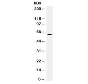 Polyclonal Rabbit anti-Human CD274 / B7-H1 / PD-L1 Antibody (WB)