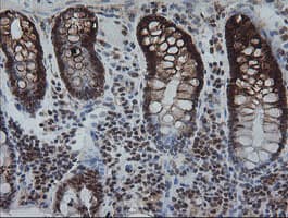 KIF25 Antibody (clone OTI2F4)