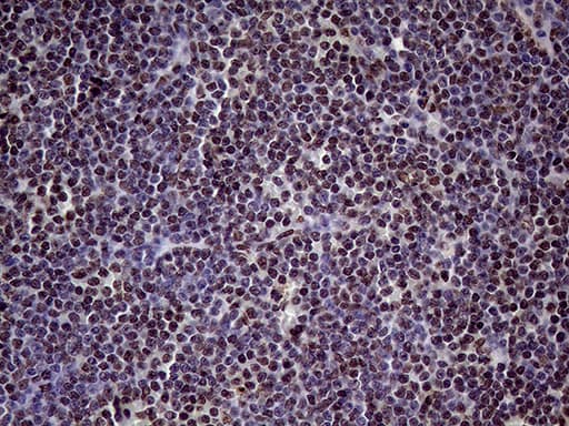 XRN2 Antibody (aa677-779, clone OTI5F4)