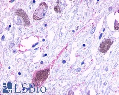 PathPlus™ HTR6 / 5-HT6 Receptor Antibody (C-Terminus)