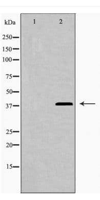 MEF2C Antibody
