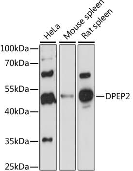 Polyclonal Rabbit anti-Human Dipeptidase 2 / DPEP2 Antibody (WB)