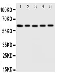 Polyclonal Rabbit anti-Human IDS / Iduronate 2 Sulfatase Antibody (aa430-448, IHC, WB)