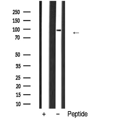 Polyclonal Rabbit anti-Human DNMT3B Antibody (IHC, IF, WB)