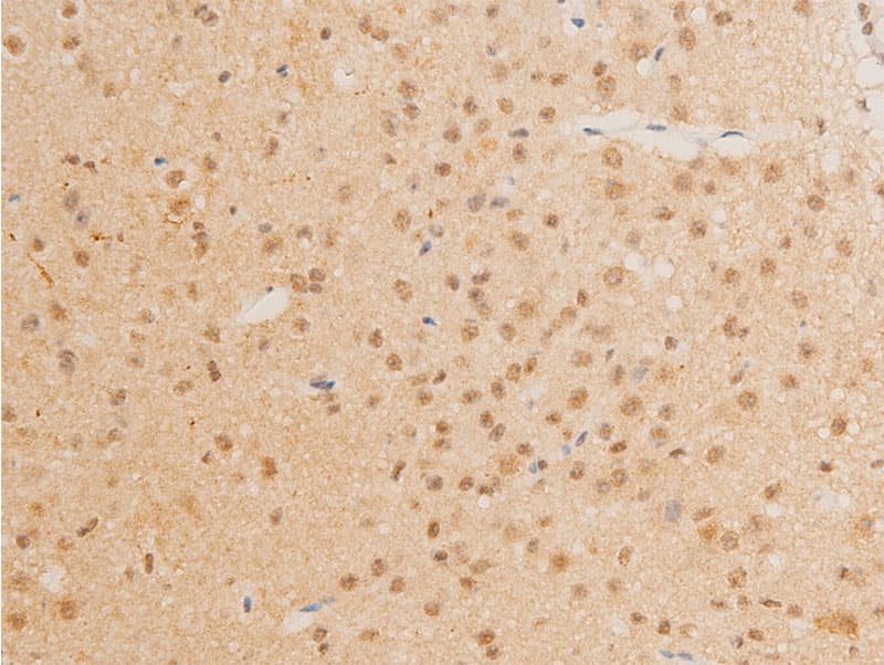 MYC / c-Myc Antibody (phospho-Thr58)