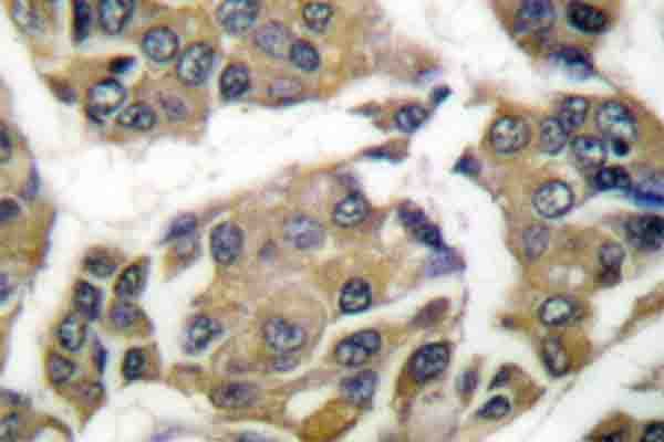 WNK1 Antibody (phospho-Thr60)