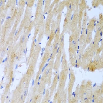 Polyclonal Rabbit anti-Human UBE2L3 / UBCH7 Antibody (IHC, WB)