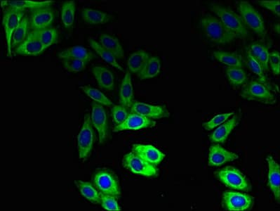 ABCB1 / MDR1 / P Glycoprotein Antibody