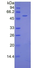Mouse FKBP5 / FKBP51 Protein (Recombinant His)