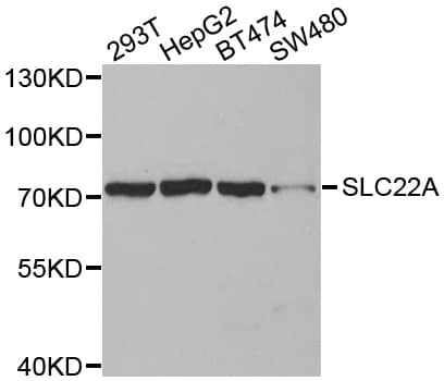Polyclonal Rabbit anti-Human SLC22A8 / OAT3 Antibody (IHC, WB)