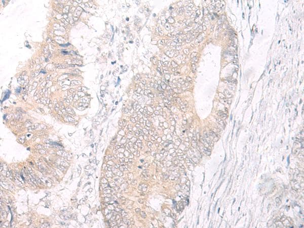 IL17A Antibody