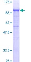 Human GALC / Galactocerebrosidase Protein (Recombinant GST)