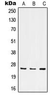 Polyclonal Rabbit anti-Human ITGA7 / Integrin Alpha 7 Antibody (C-Terminus, WB)