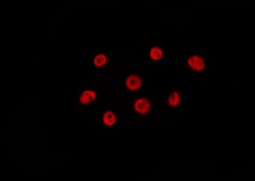 HIST3H3 Antibody (Methyl-Lys9)