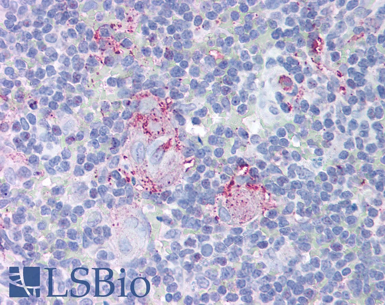 IHC-plus™ MTBP / Mdm2-Binding Protein Antibody