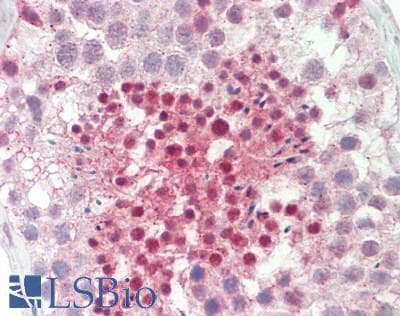 IHC-plus™ DCAF6 / NRIP Antibody (aa300-350)