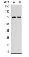 EME1 Antibody