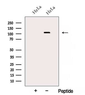 AP3D1 / Adaptin Delta Antibody