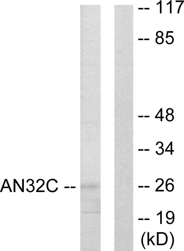 ANP32C Antibody