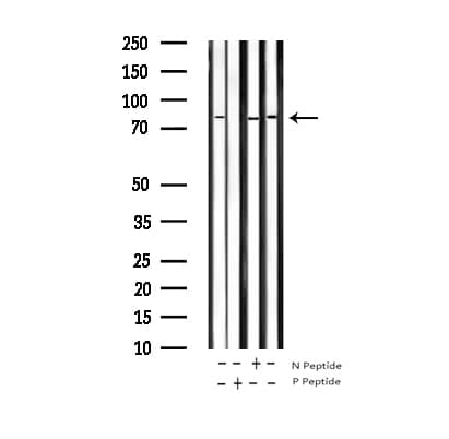 STAT5A Antibody (phospho-Ser780)