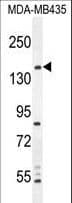 CAMSAP1 Antibody (aa34-62)