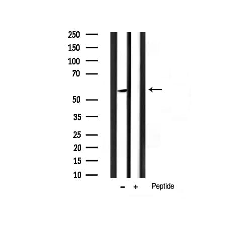 AKT1 Antibody (phospho-Ser124)
