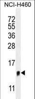 TMEM100 Antibody (aa93-122)