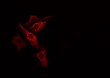 Polyclonal Rabbit anti-Human PGLS / 6PGL Antibody (IHC, IF, WB)