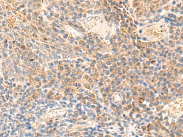 ABHD2 Antibody