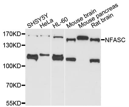 IHC-plus™ Polyclonal Rabbit anti-Human Neurofascin / NF Antibody (IHC, WB)
