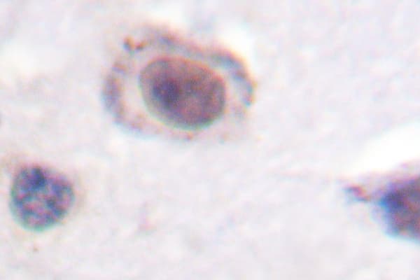 CCND1 / Cyclin D1 Antibody (Leu283)
