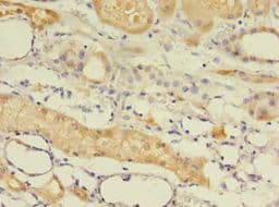 EPHX2 / Epoxide Hydrolase 2 Antibody (aa1-555)