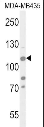 Polyclonal Rabbit anti-Human KDM4B / JMJD2B Antibody (Thr305, WB)