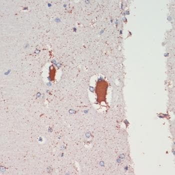 LRRK2 Antibody