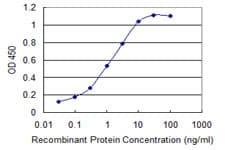 IHC-plus™ SPINK1 Antibody (clone 4D4)