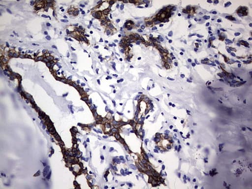 KRT19 / CK19 / Cytokeratin 19 Antibody (aa240-390, clone OTI8D1)