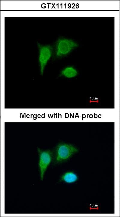 TP53I3 / PIG3 Antibody (aa1-332)