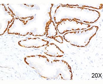 KRT14 / CK14 / Cytokeratin 14 Antibody (C-Terminus, clone LL002, Azide-free, BSA-free)