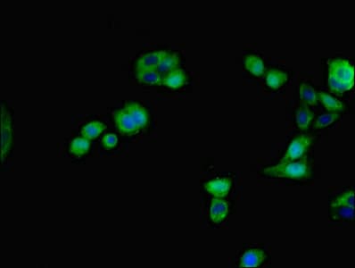 IHC-plus™ IHH Antibody