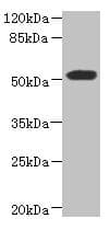 Polyclonal Rabbit anti-Human UBXD9 / ASPL Antibody (IHC, WB)