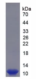 Human S100 Protein (Recombinant His-S)