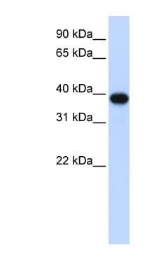 PathPlus™ Polyclonal Rabbit anti-Human CDK1 / CDC2 Antibody (aa121-170, IHC, WB)
