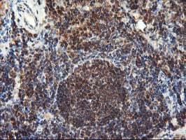 Monoclonal Mouse anti-Human LCMT1 Antibody (clone OTI2C9, IHC, WB)