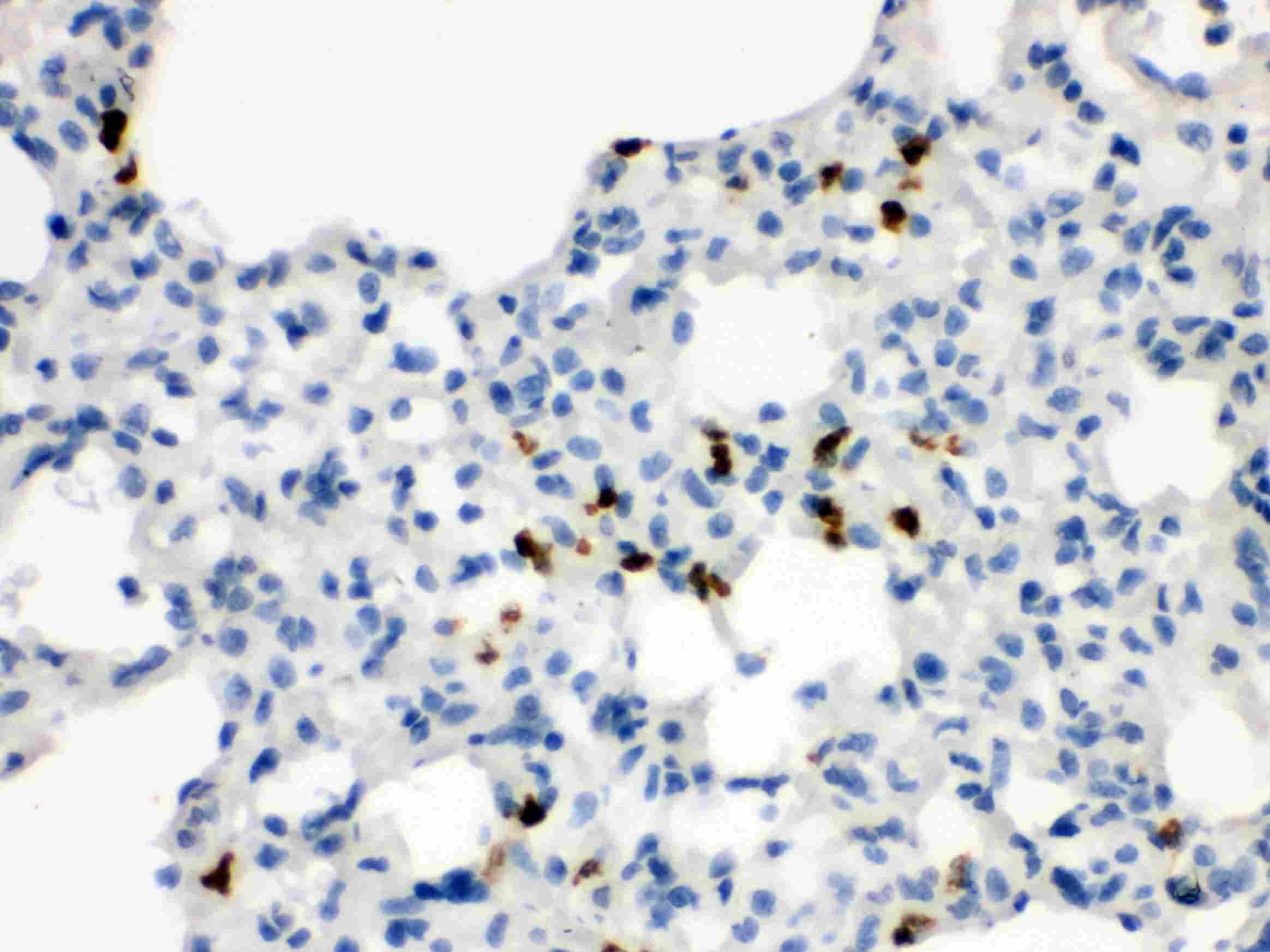 Polyclonal Rabbit anti-Human WNT7A Antibody (aa226-256, IHC, WB)