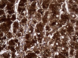 NME1 / NM23 Antibody (clone OTI2A5)